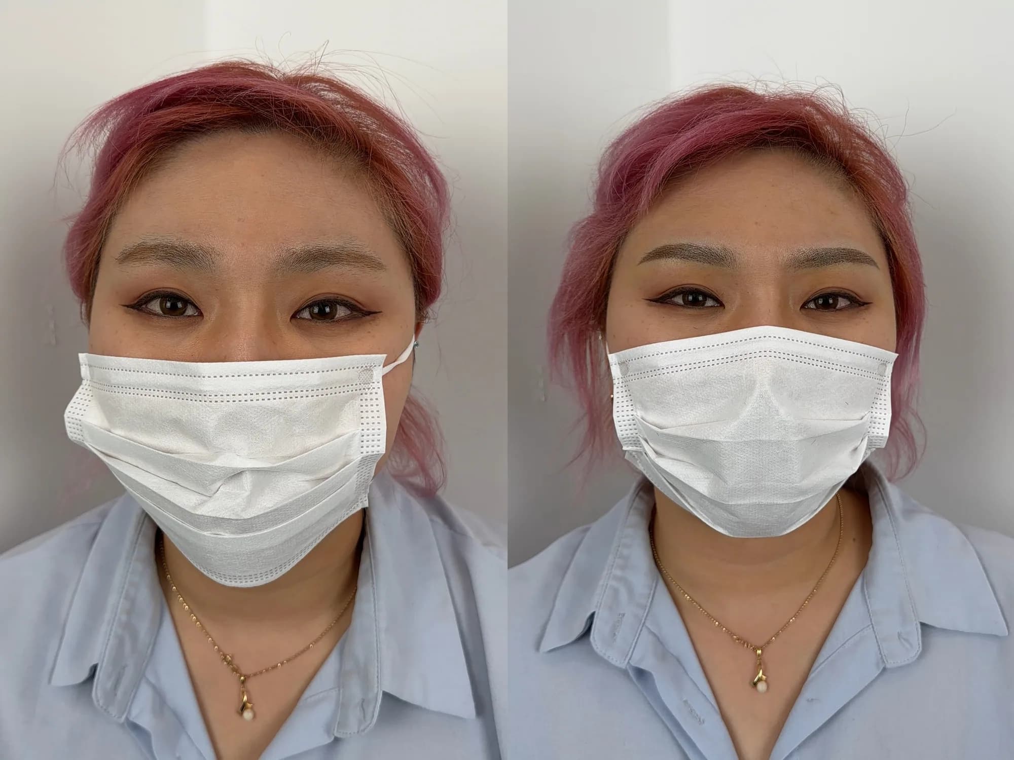 눈썹 시술 후 결과