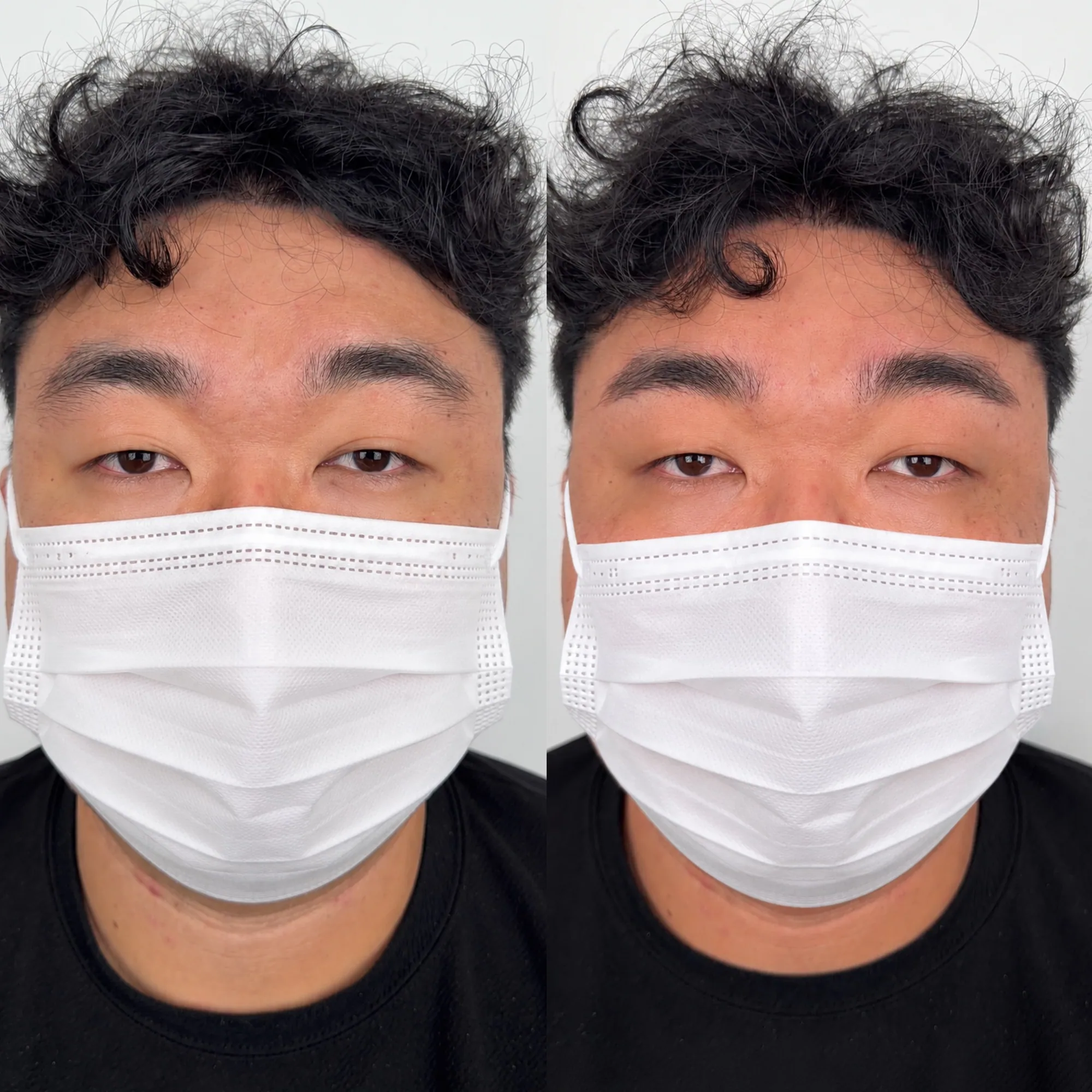 눈썹 시술 후 결과